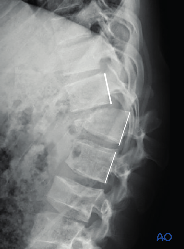 Patient Examination: Radiological evaluation (XR,CT, MRI)