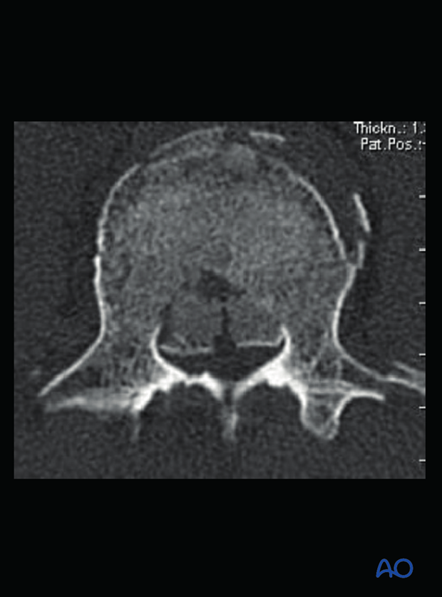 Patient Examination: Radiological evaluation (XR,CT, MRI)