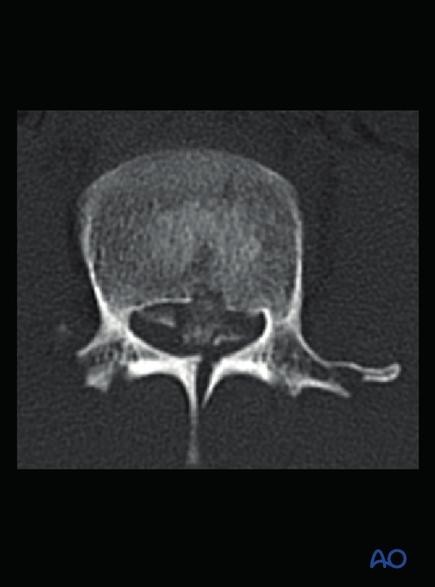 Patient Examination: Radiological evaluation (XR,CT, MRI)