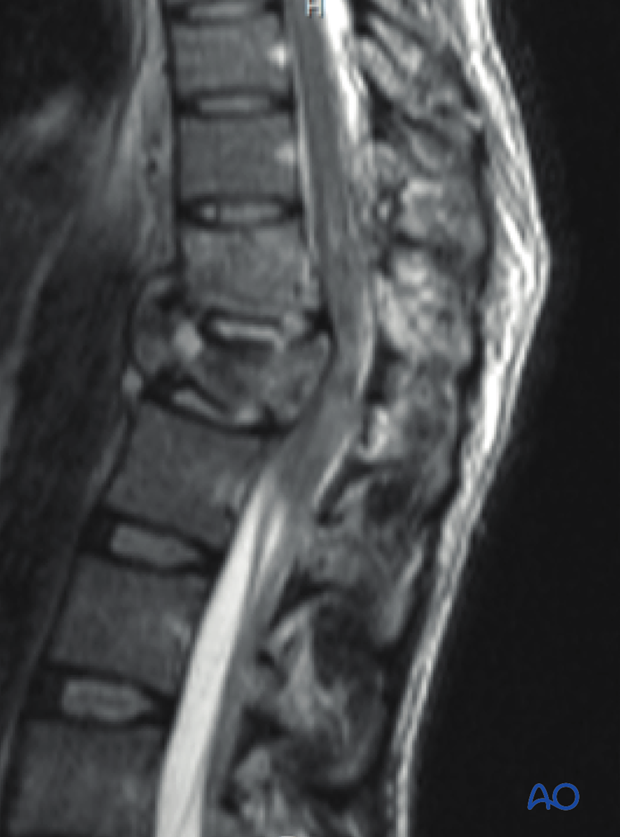 Patient Examination: Radiological evaluation (XR,CT, MRI)