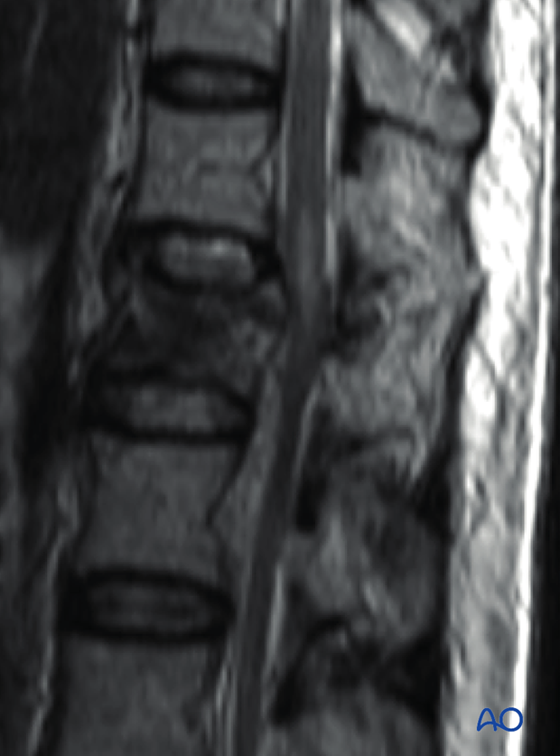 Patient Examination: Radiological evaluation (XR,CT, MRI)