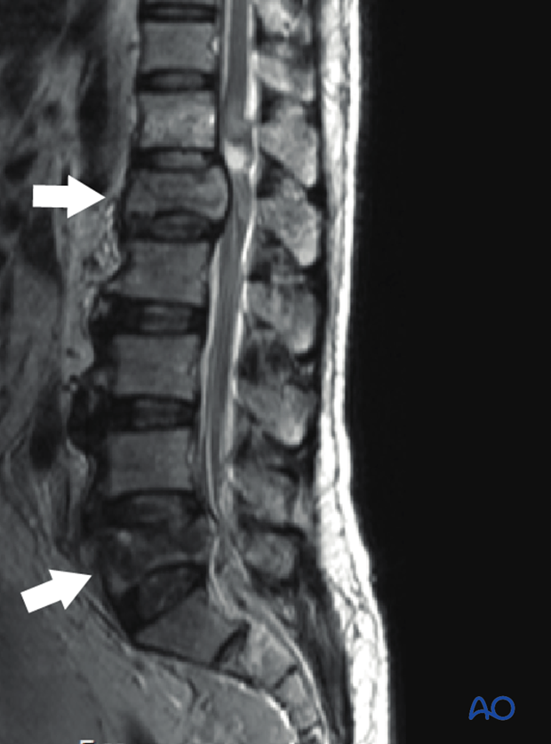 Patient Examination: Radiological evaluation (XR,CT, MRI)