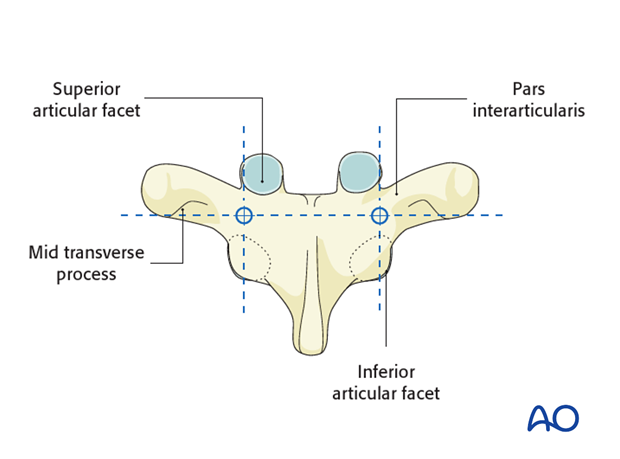 pedicle screw insertion