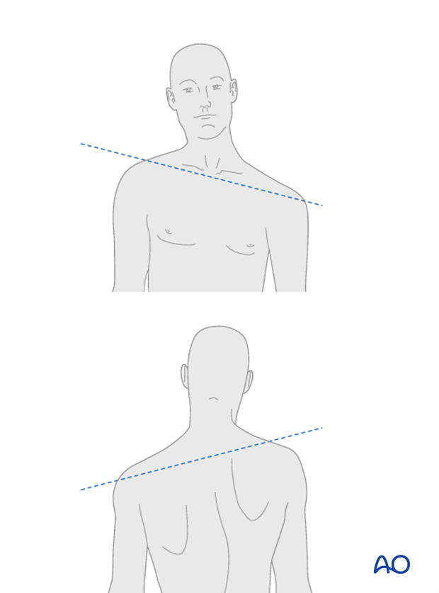 patient examination