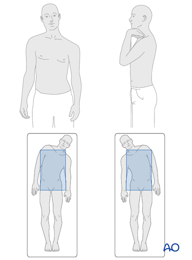 lenke classification