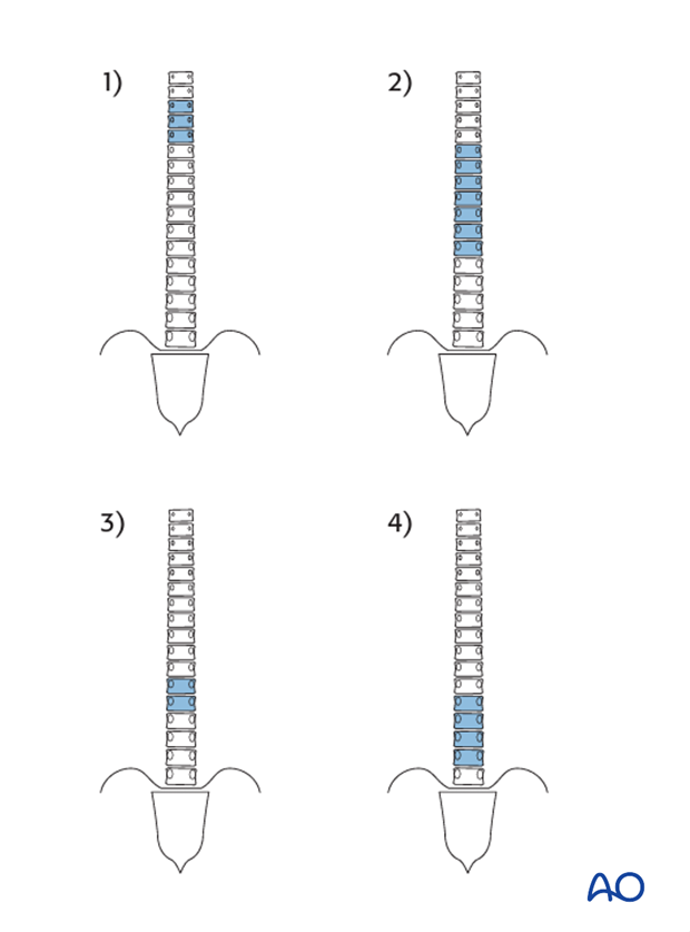 lenke classification