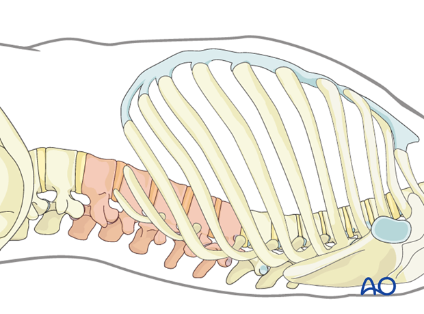 minimally invasive left side thoracic approach