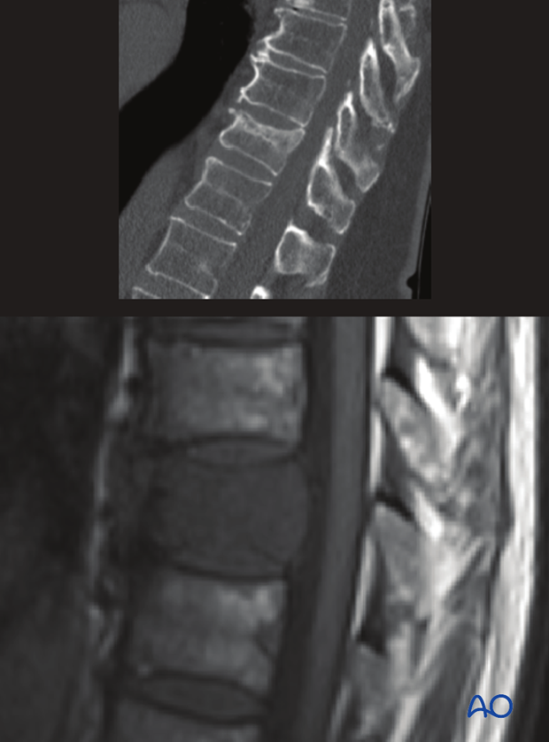 evaluation of stability