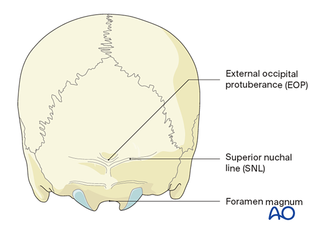 posterior midline approach to c0 to c2