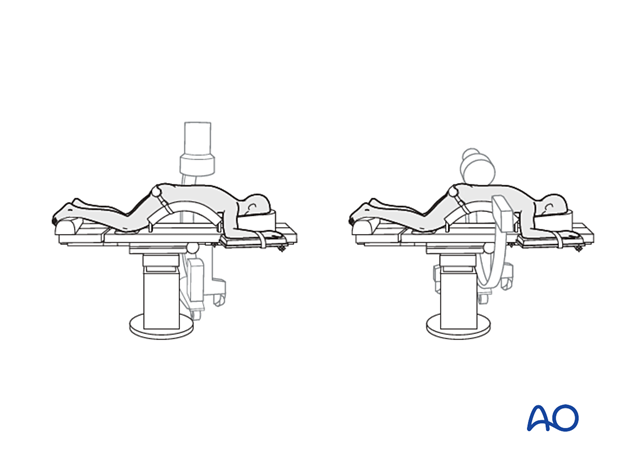 C-arm in AP and lateral position while the patient is in a prone position for approaches to L1–L5