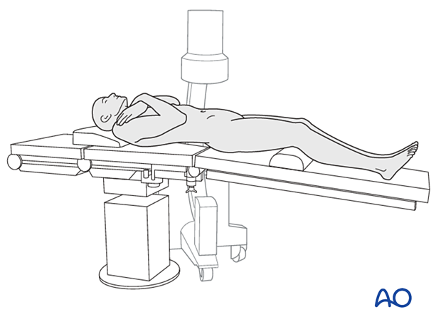 Patient in a supine position with arms folded across the chest for Anterior lumbar interbody fusion (ALIF)