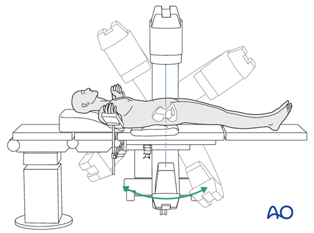 supine position