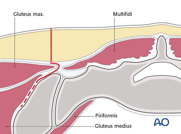 posterior approach to the si joint