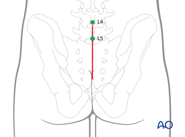 operative treatment