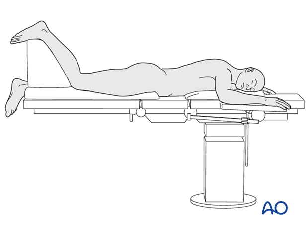 prone position