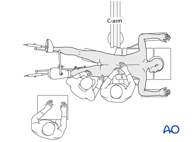 prone position