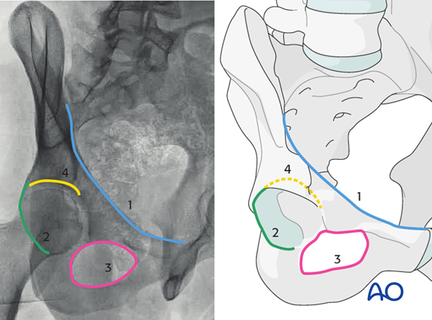 radiology of the intact acetabulum