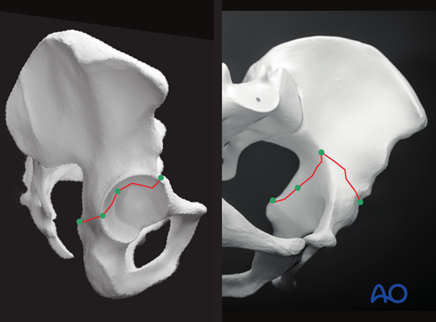 radiology of the intact acetabulum