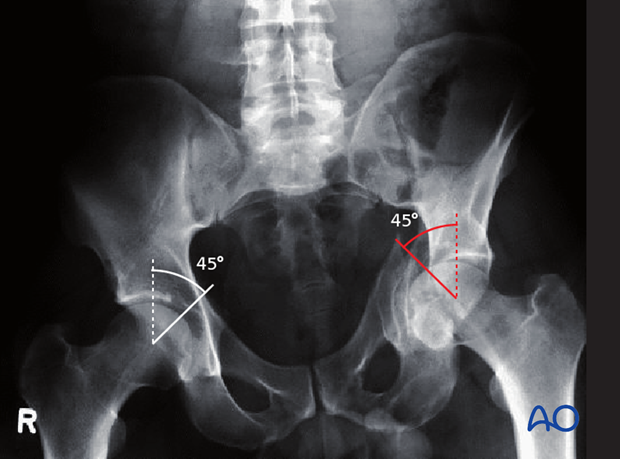 decision making nonoperative vs surgical treatment