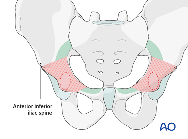 general stabilization principles and screw directions