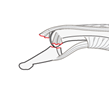 Contour defects