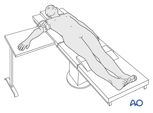 Patient place supine with the arm on a hand table