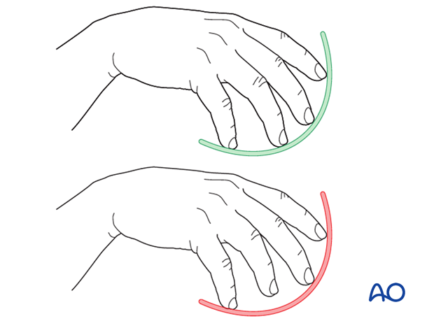 Correct and interrupted cascade of fingers