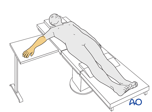 Patient in supine position with the disinfected arm on a side table