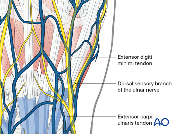 Surgical anatomy of the dorsal aspect around the 5th carpometacarpal joint