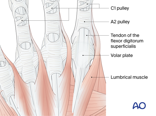 Tendinous anatomy of the metacarpals and proximal phalanges