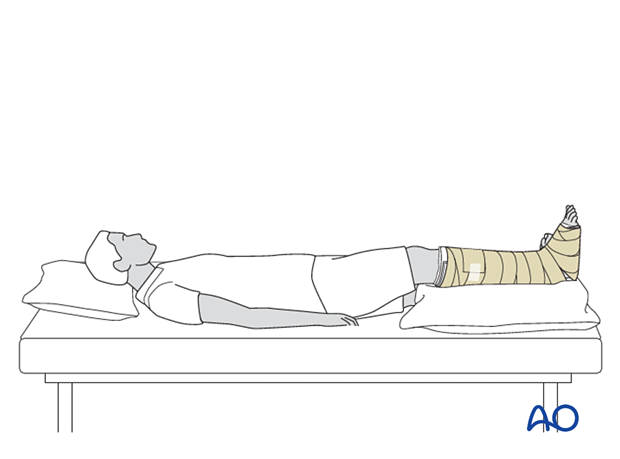 Supine patient with elevated extremity