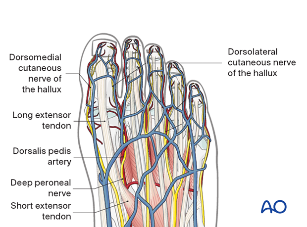 Important relevant anatomical structures when approaching the first metatarsal