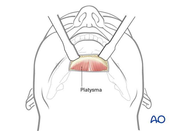 Dissection