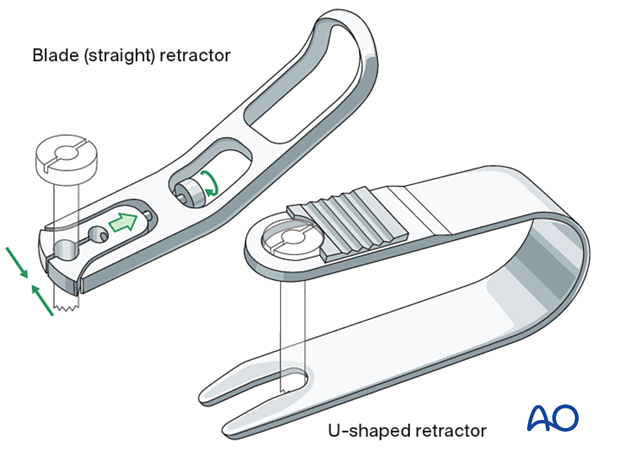 Mountable retractor