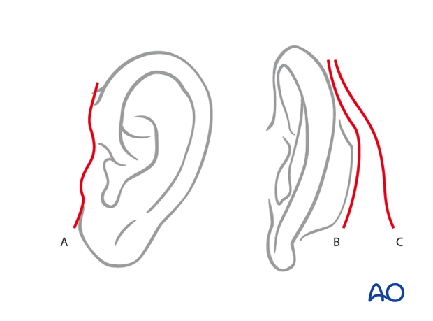 Examples of extentions