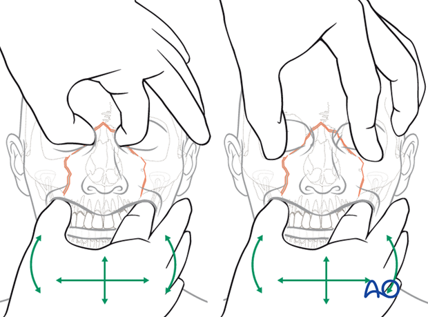 examination of patients with midfacial injuries