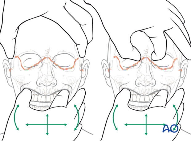 examination of patients with midfacial injuries