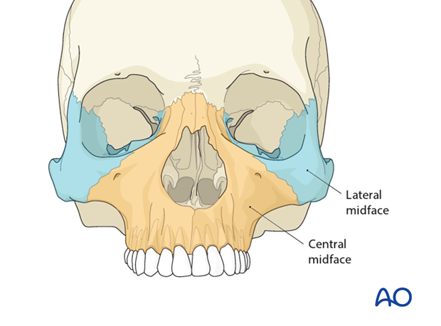 AOCMF Classification Midface (Level 1 and 2)