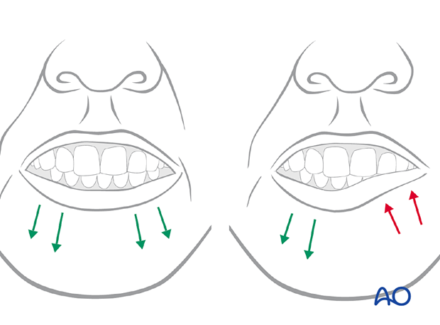 examination of patients with midfacial injuries