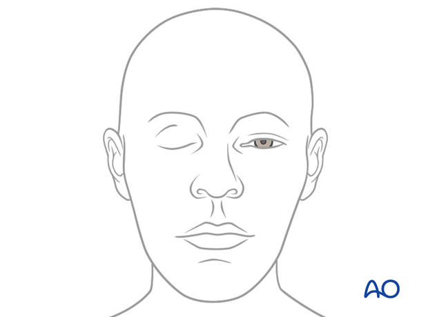 examination of patients with midfacial injuries