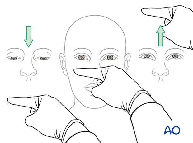 examination of patients with midfacial injuries