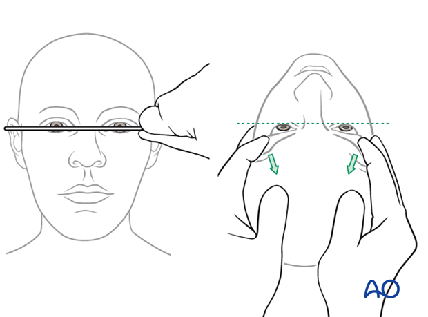 examination of patients with midfacial injuries