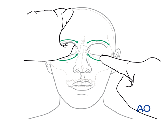 examination of patients with midfacial injuries