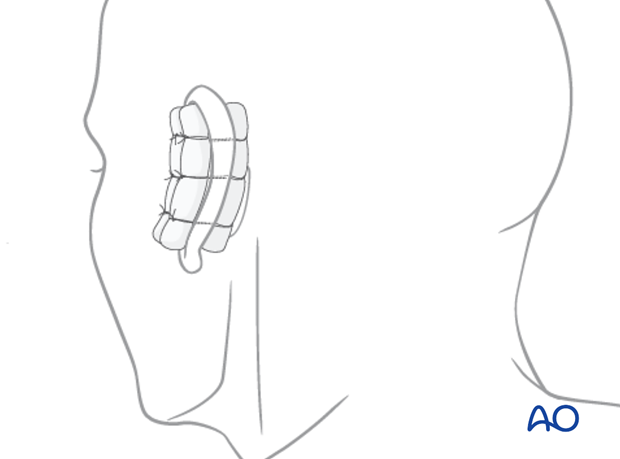 examination of patients with midfacial injuries