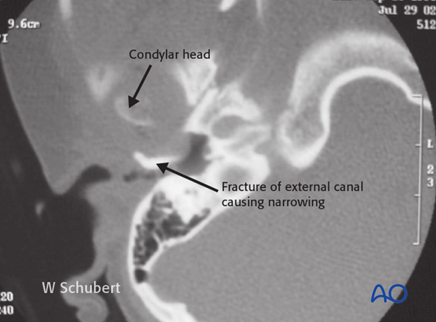 examination of patients with midfacial injuries