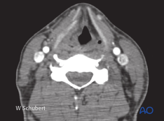 examination of patients with midfacial injuries