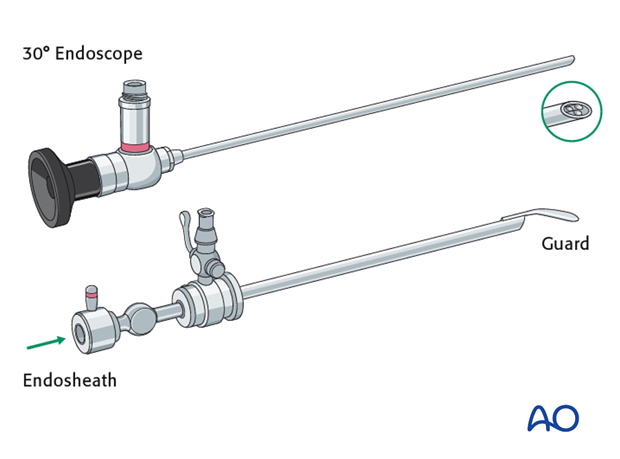 Endoscopic approach to the anterior table