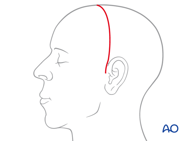 Inferior extent of incision line