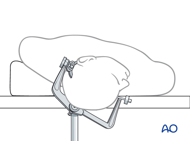 Lateral skull base approach