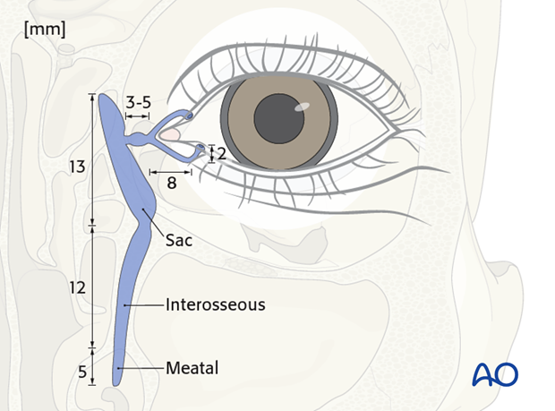 Repair of periorbital soft-tissue injuries and lacrimal system in NOE injuries